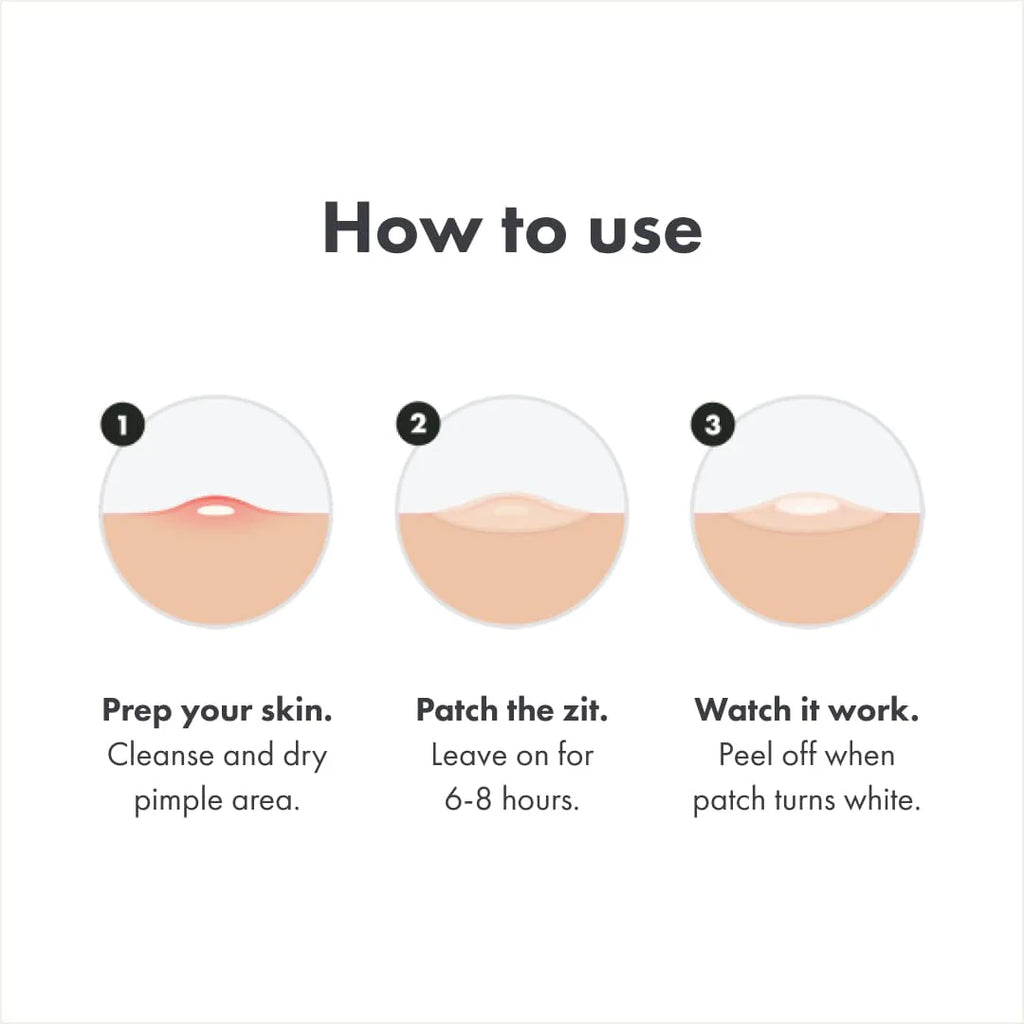 Hydrocolloid Acne Pimple Patch (27 Patches) W4544